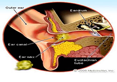 rochdale ear care clinic